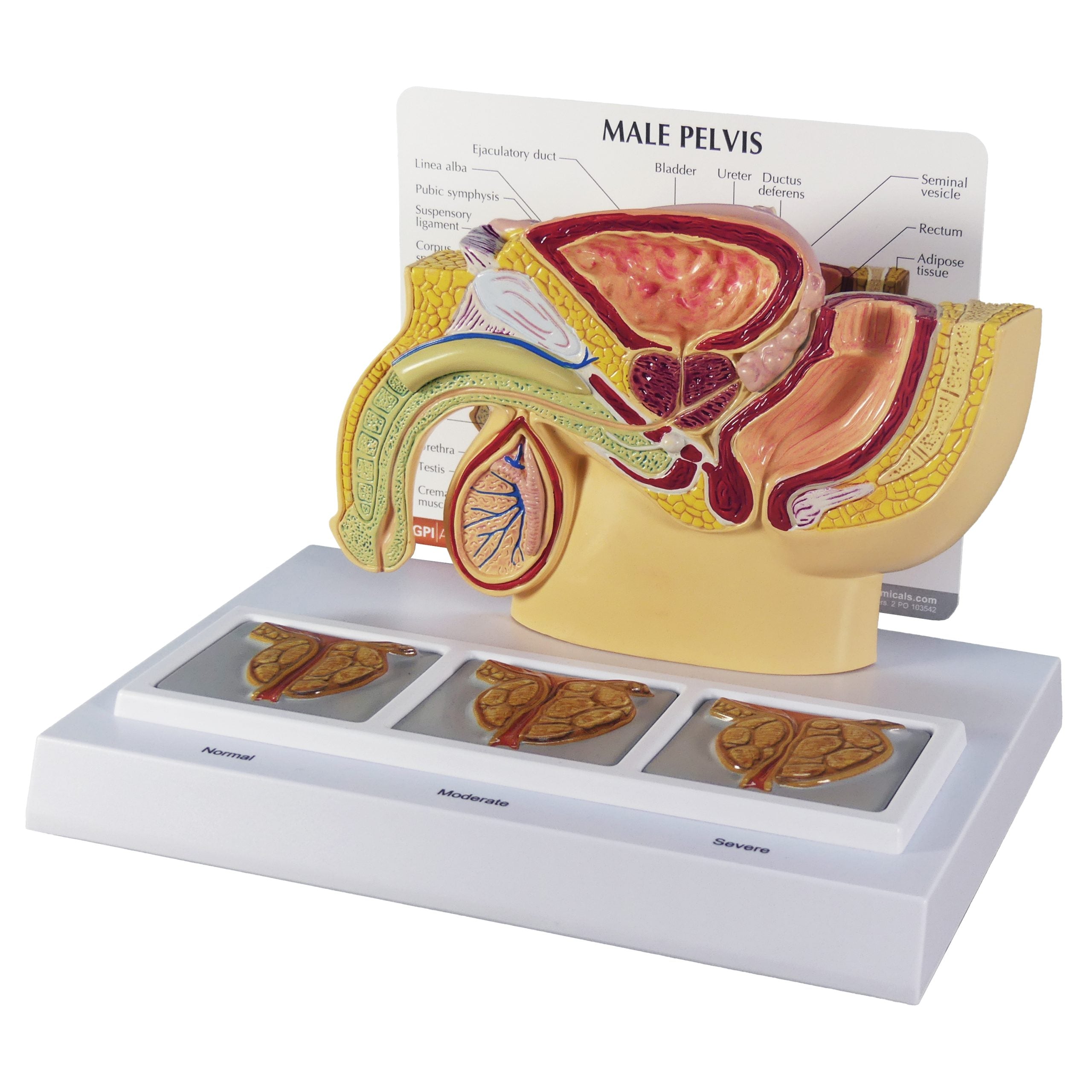 Male Pelvis with 3D Prostate Frame