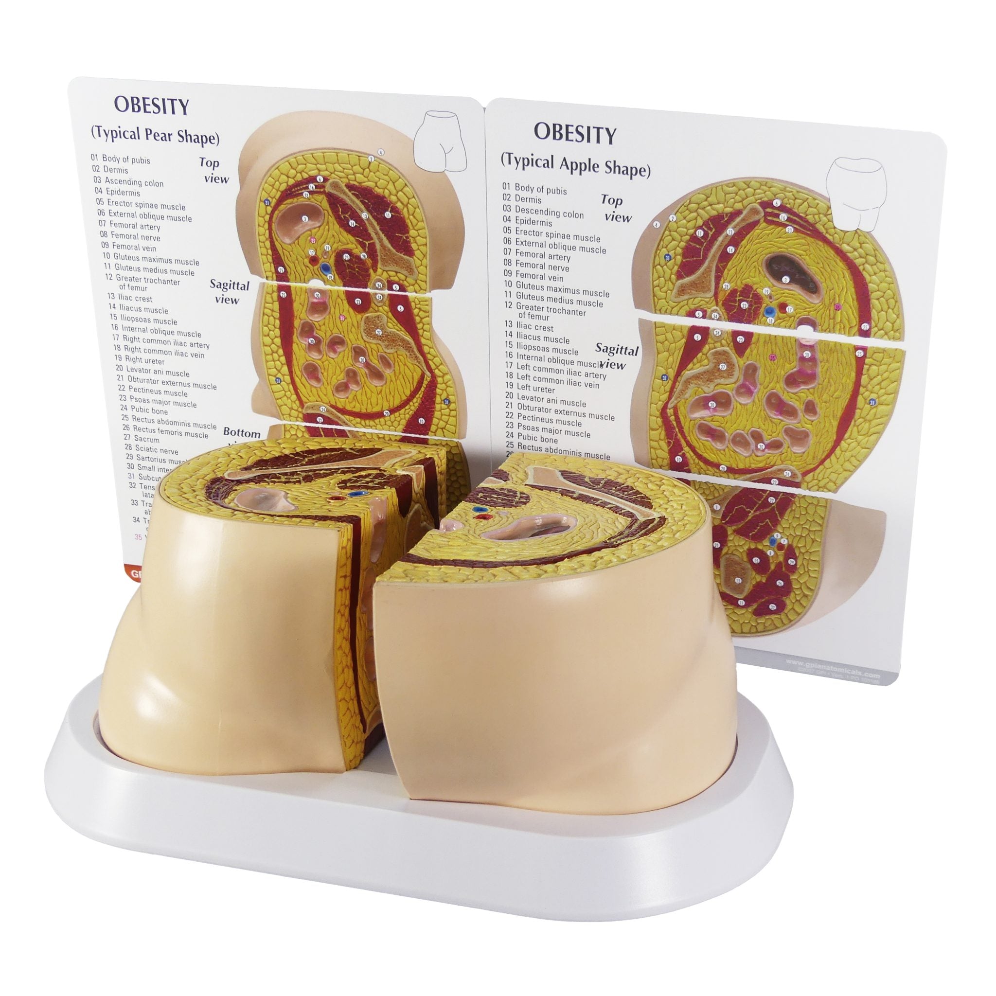 Obesity model
