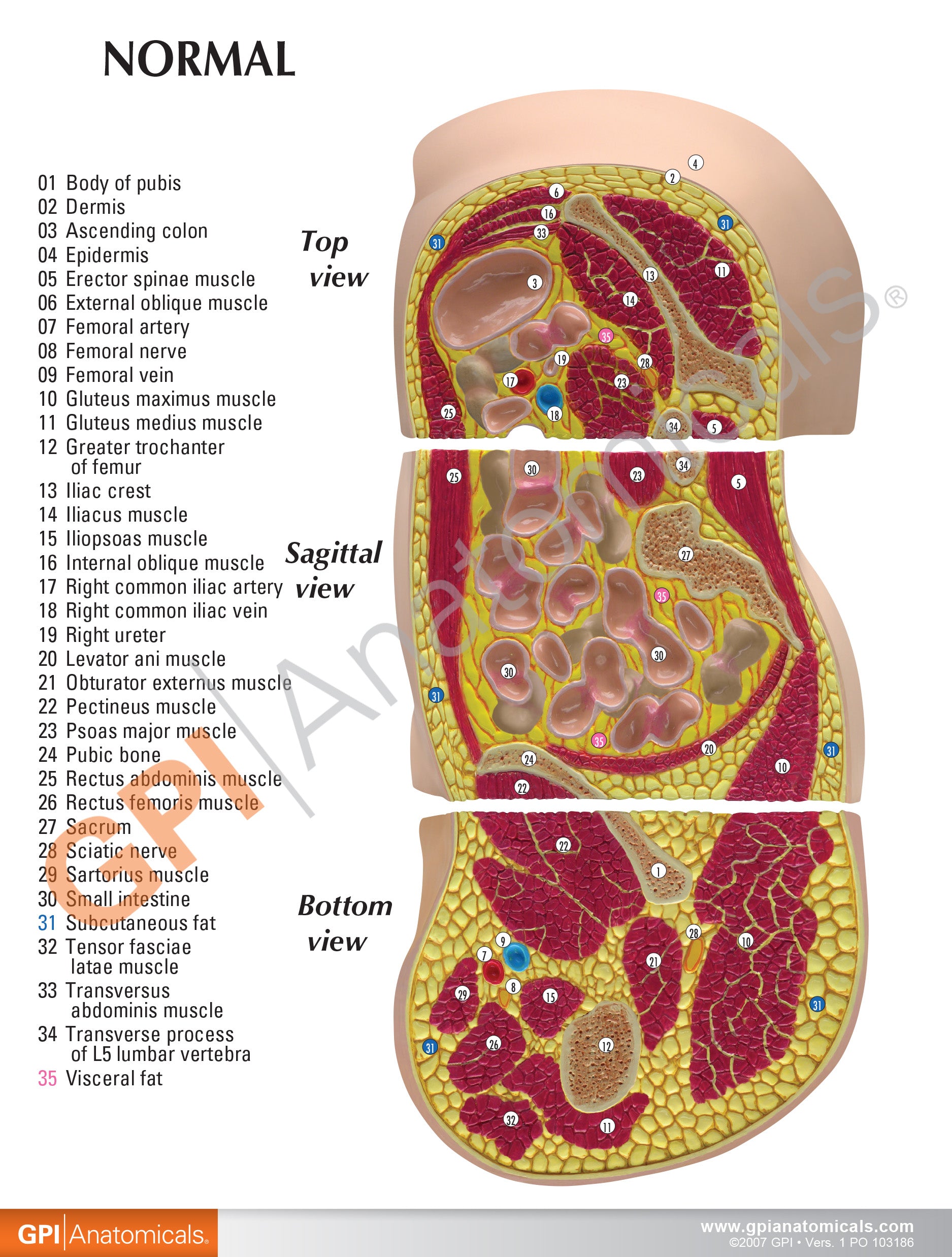 Obesity model