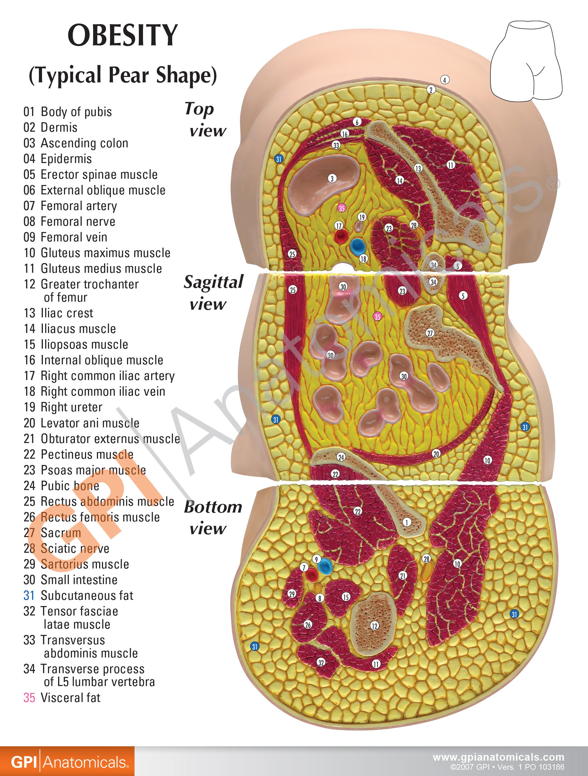 Obesity model