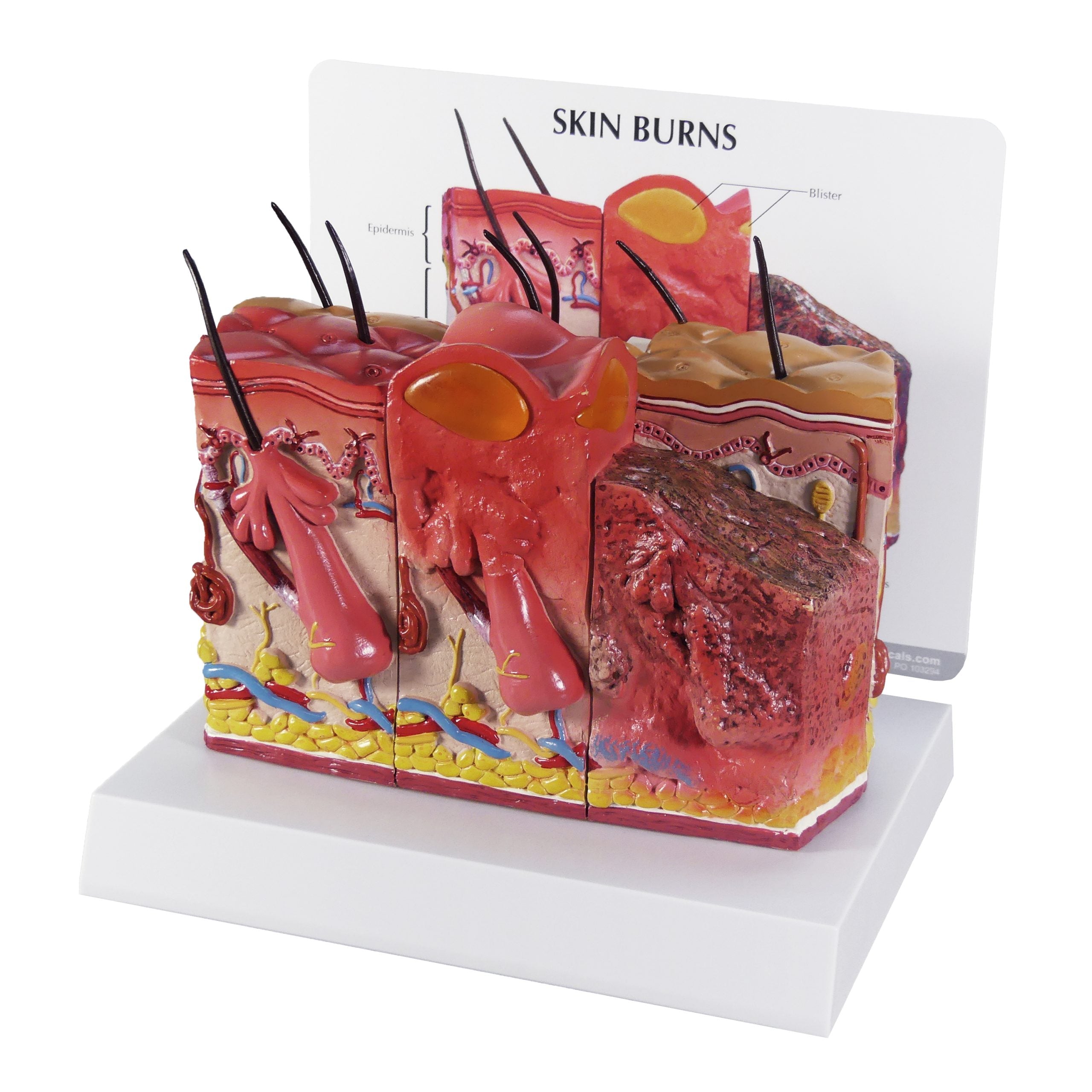 Skin Burn & Normal Skin (2-Sided)