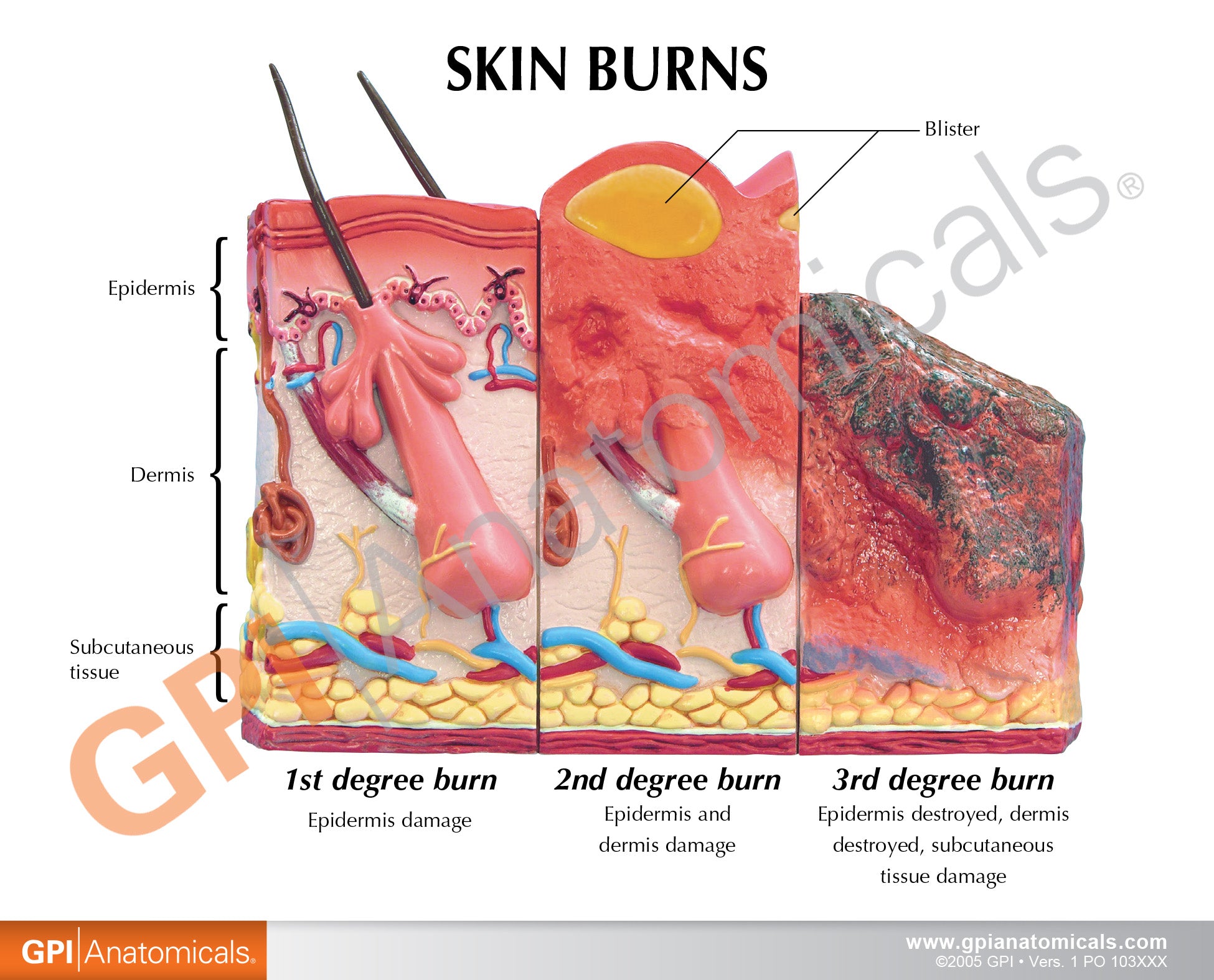 Skin Burn & Normal Skin (2-Sided)