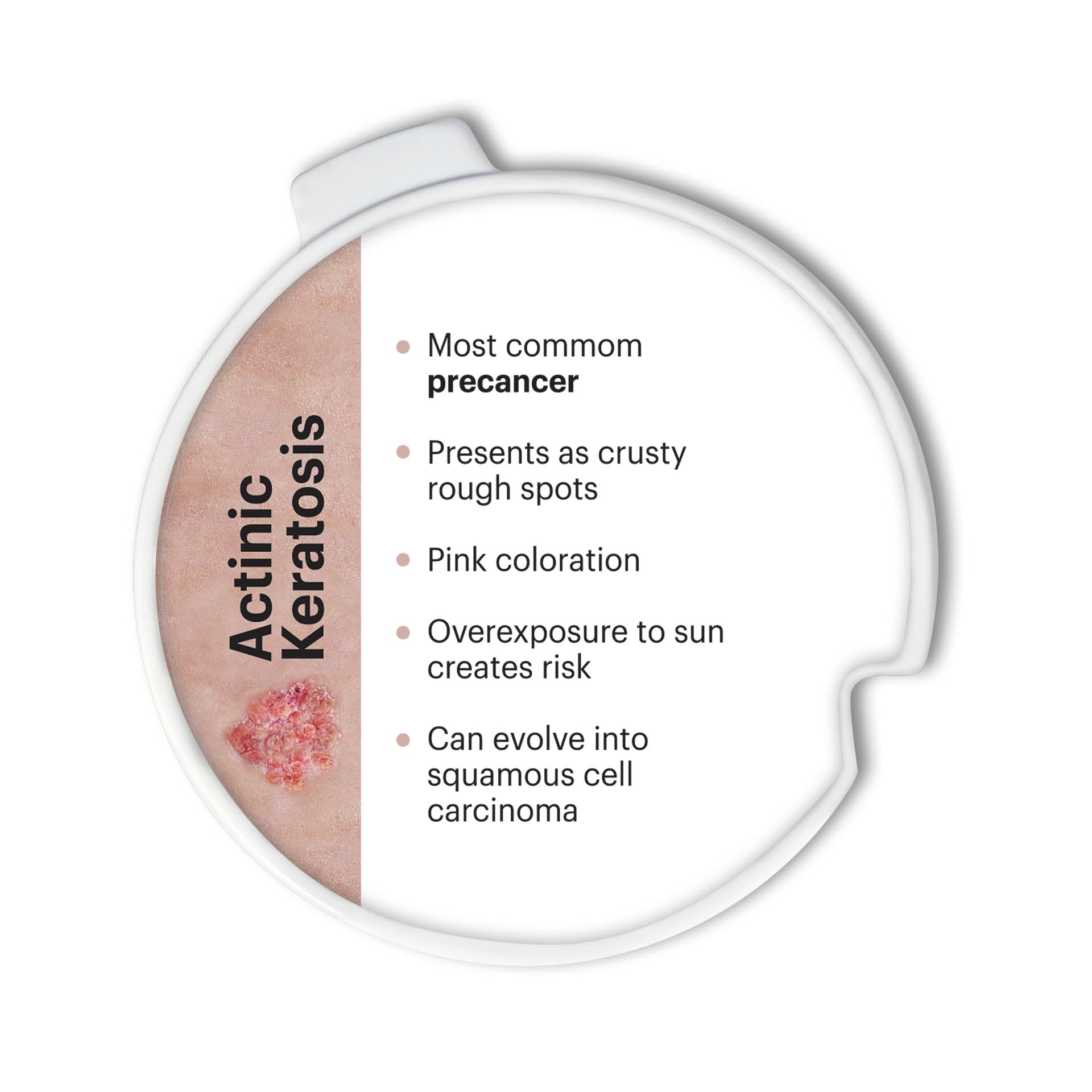 Precancerous & Cancerous Skin Lesions Hinged Disk Set
