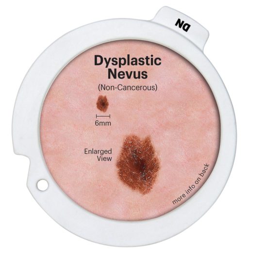 Precancerous & Cancerous Skin Lesions Hinged Disk Set