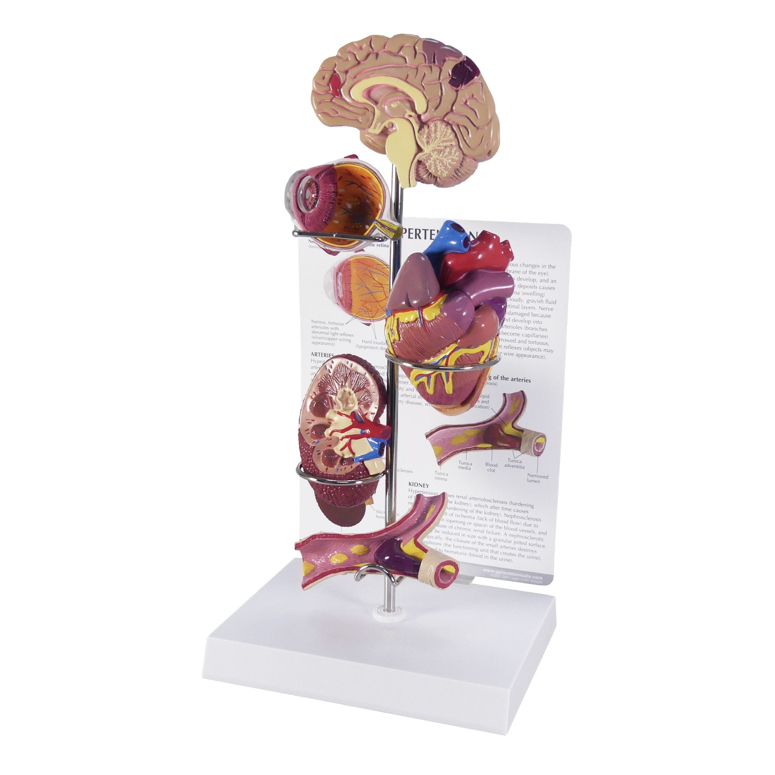 Hypertension Set (5x)