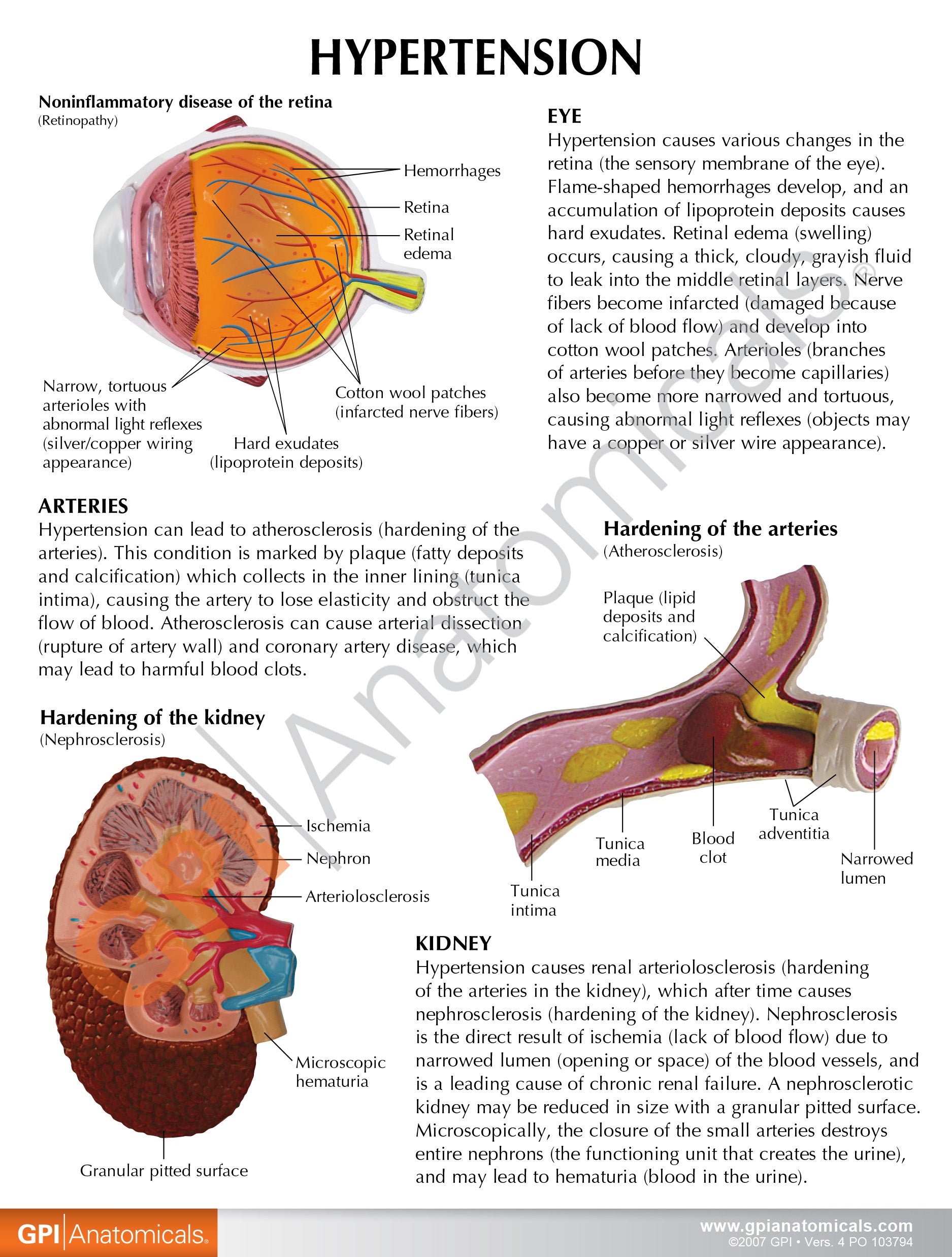 Hypertension Set (5x)