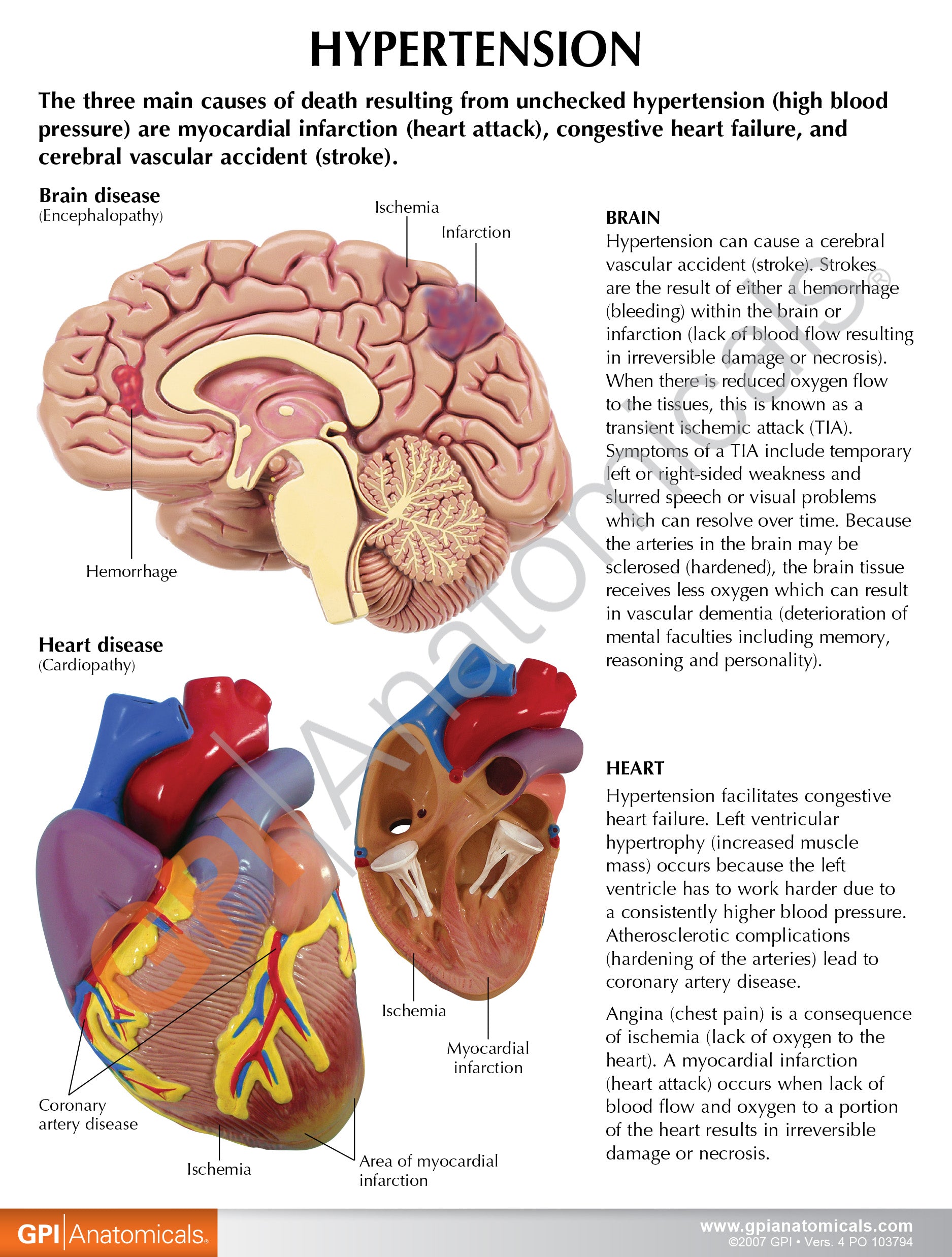 Hypertension Set (5x)