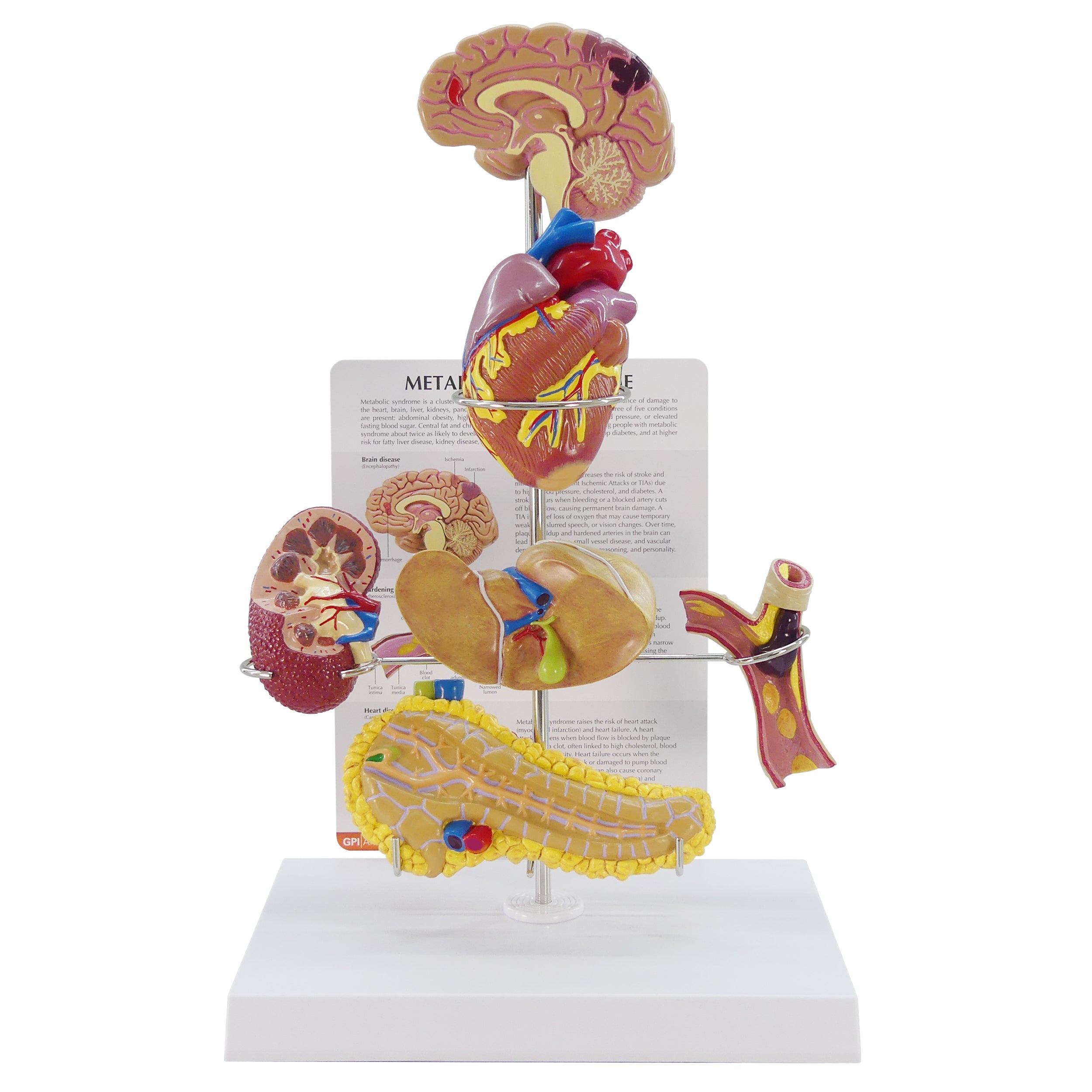 Metabolic Syndrome Set (6x)