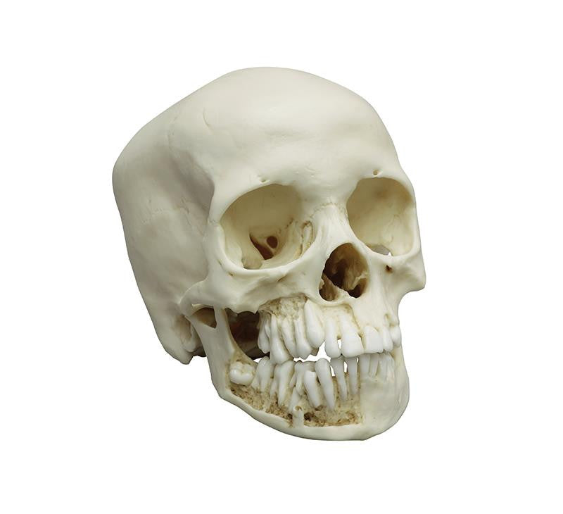 Child skull, 12 year old | Erler-Zimmer E4725 | Candent