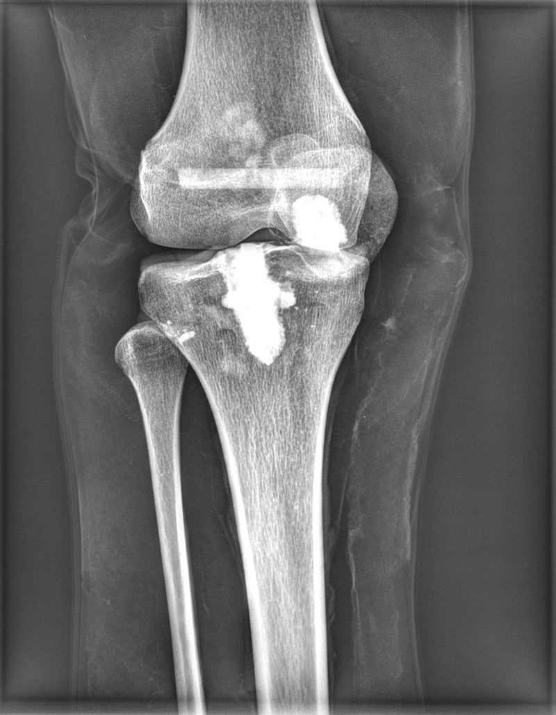 Full Body X-Ray Phantom - Knee