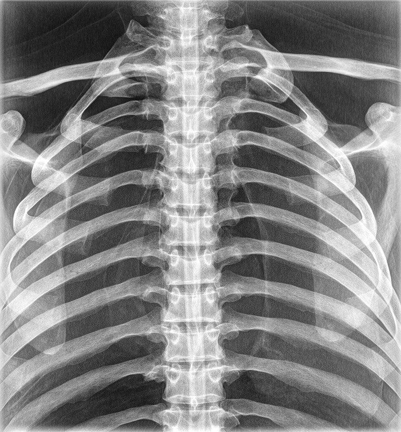 Full Body X-Ray Phantom - Ribcage