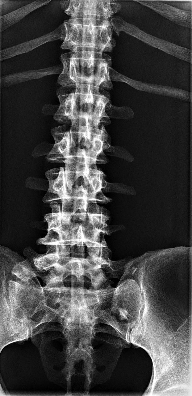 Full Body X-Ray Phantom - Spinal Column