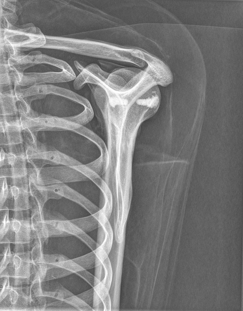 Full Body X-Ray Phantom - Shoulder X-ray