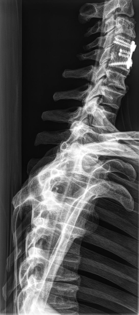 Full Body X-Ray Phantom - Cervical Spine
