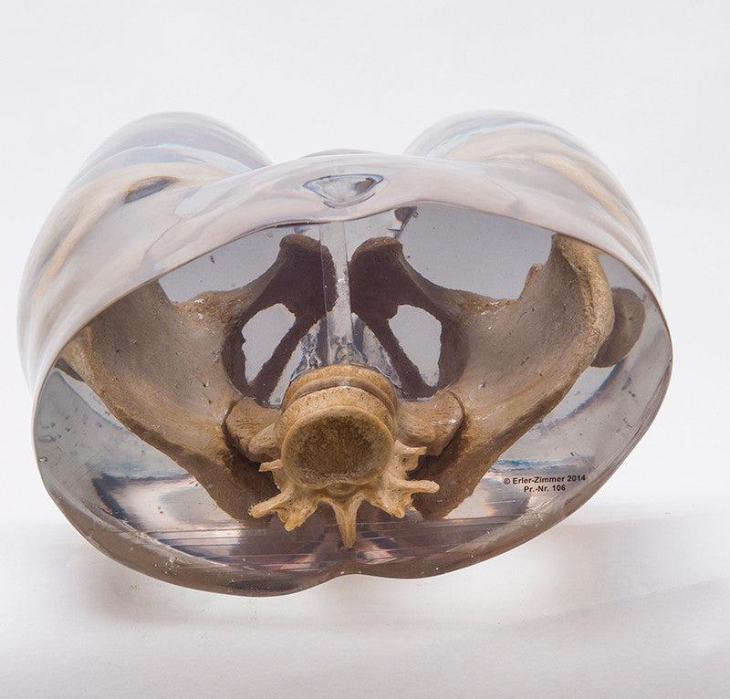 X-Ray phantom pelvis, transparent