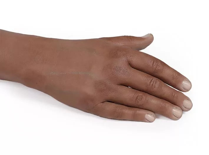 Puncture Pete – hyperrealistic IV training arm, dark skin color