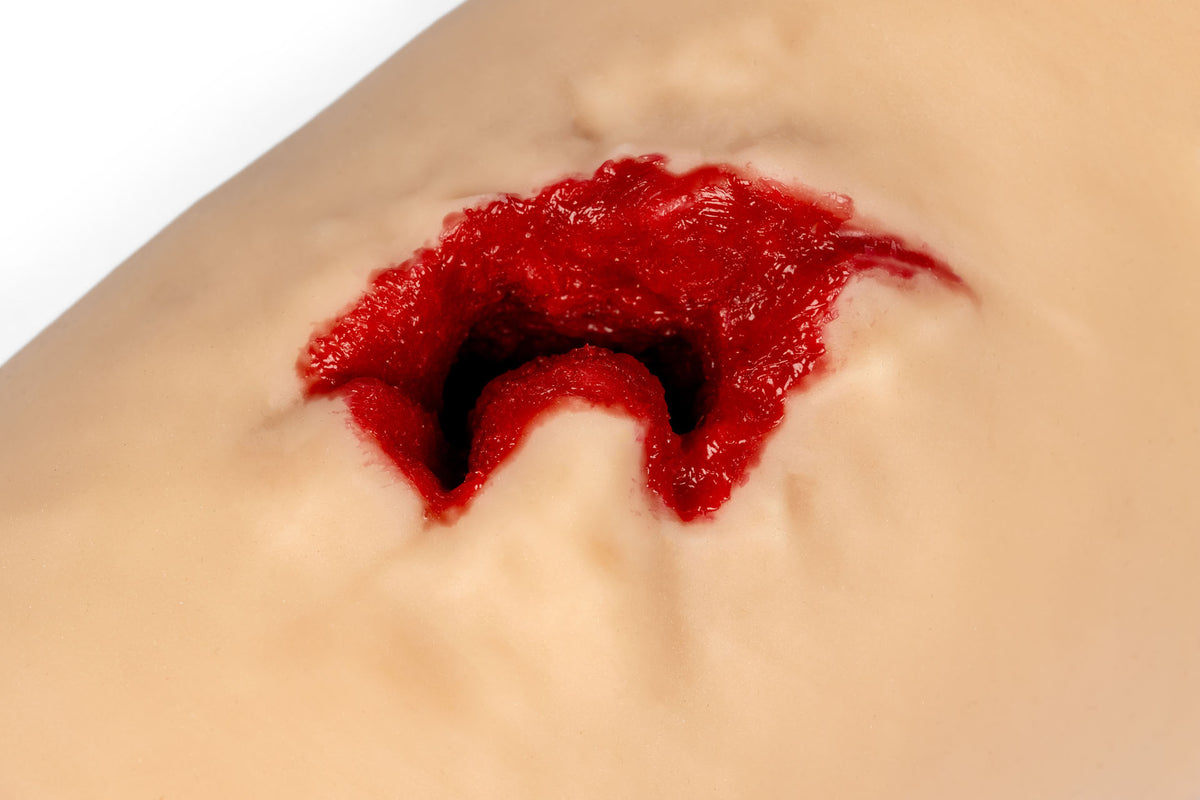 “Bill” Wound Packing Trainer with Bone Fragments | Erler-Zimmer 7777-2
