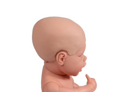 Hydrocephalus cover for baby dolls - Erler-Zimmer 7810, view 3