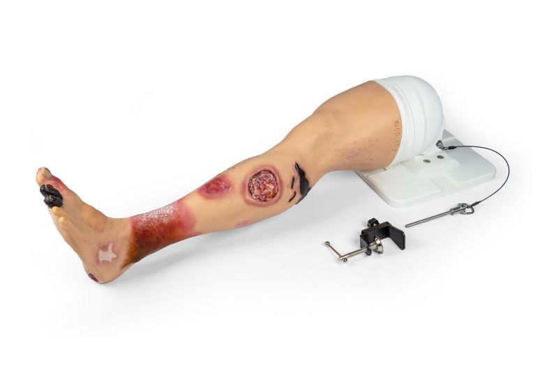"Lena Leg" - Leg with medical conditions