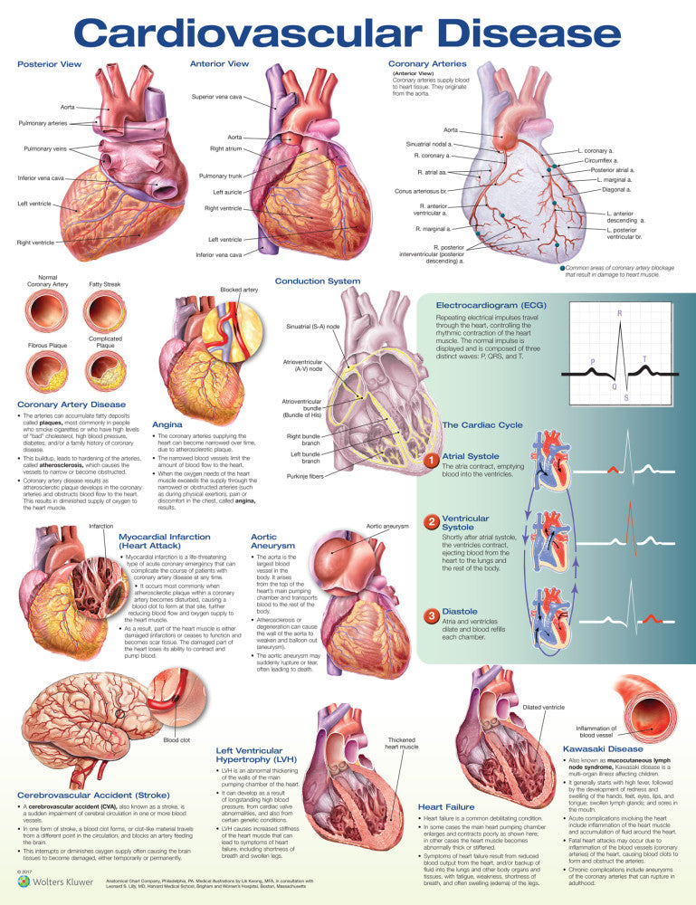 Cardiovascular Disease Anatomical Chart - 3rd Edition