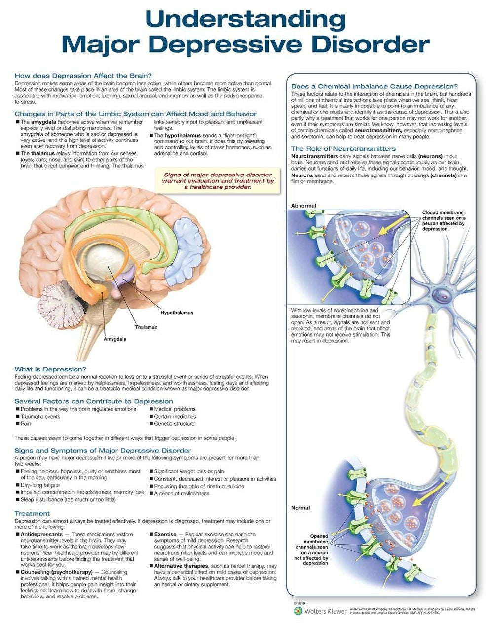Understanding Major Depressive Disorder Laminated Anatomical Chart - 3rd Edition