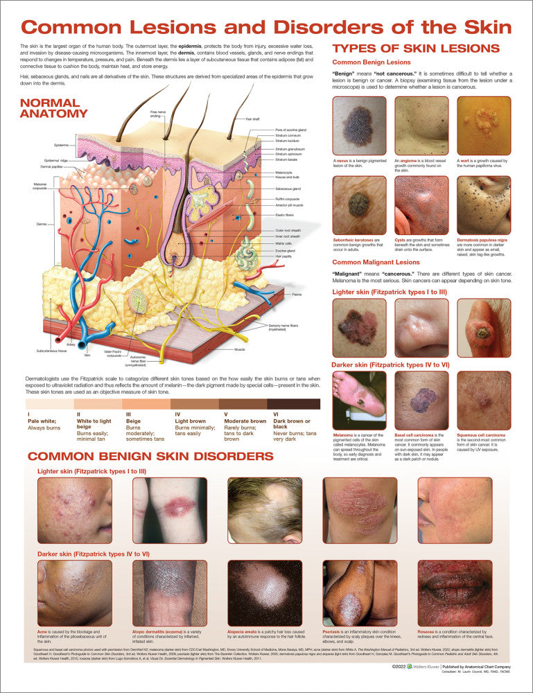 Common Lesions and Disorders of the Skin Anatomical Chart - 3rd Edition