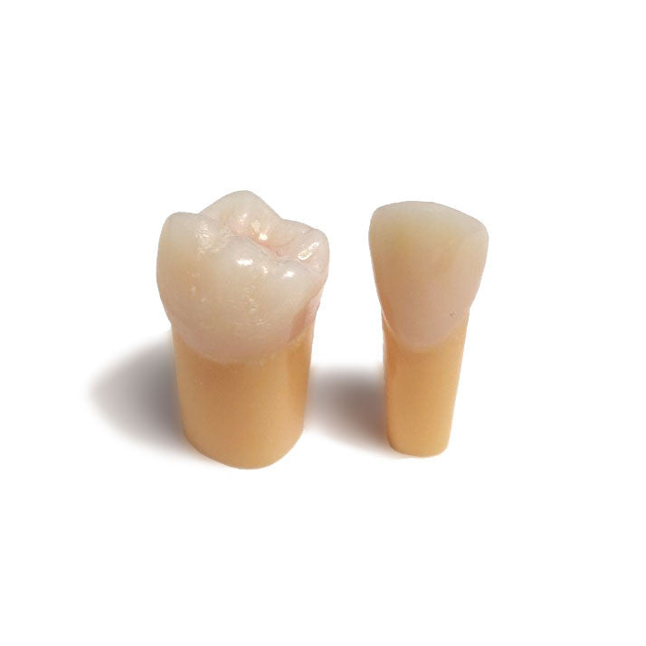 Composite Resin Tooth with Orange Caries for NDEB