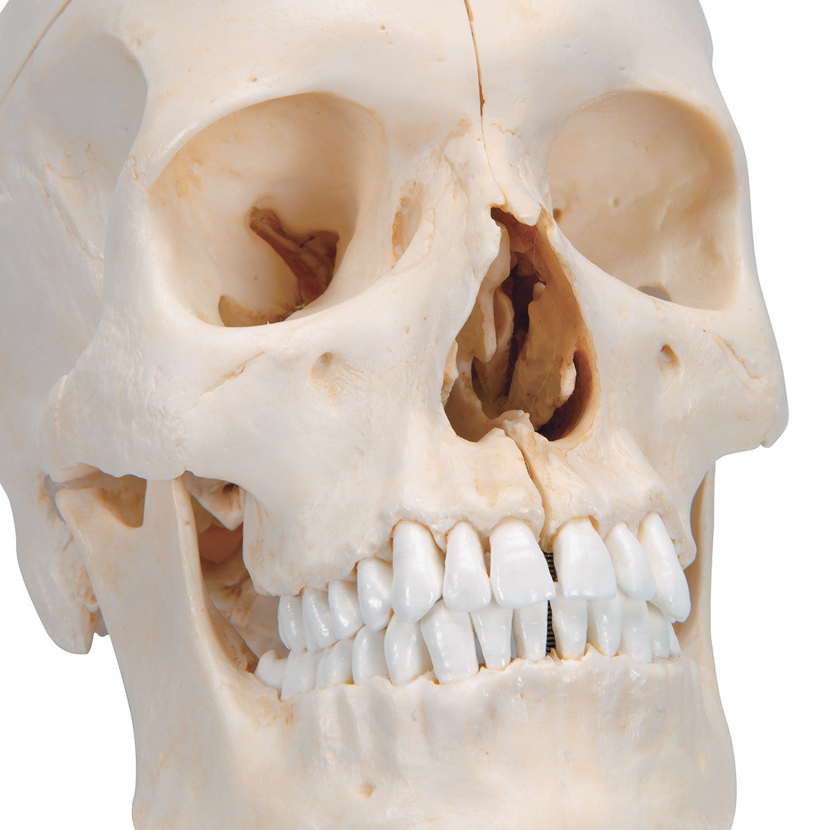 Bony Skull, 6-part | 3B Scientific A281