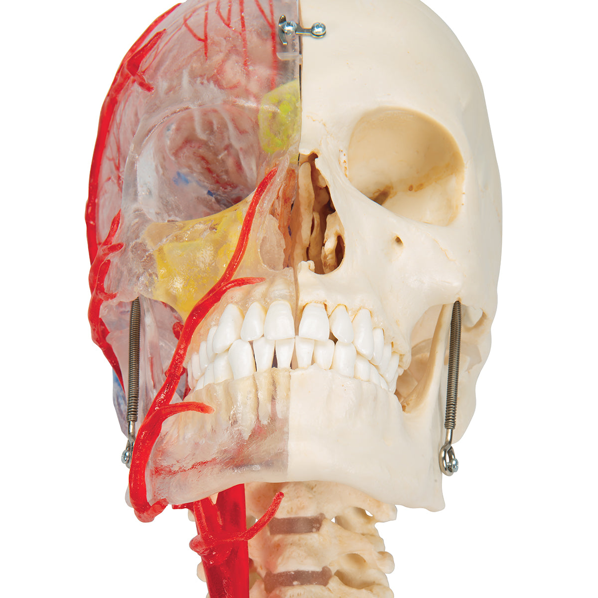 BONElike Human Skull Model, Half Transparent & Half Bony, Complete with Brain & Vertebrae - 3B Scientific A283, view 20
