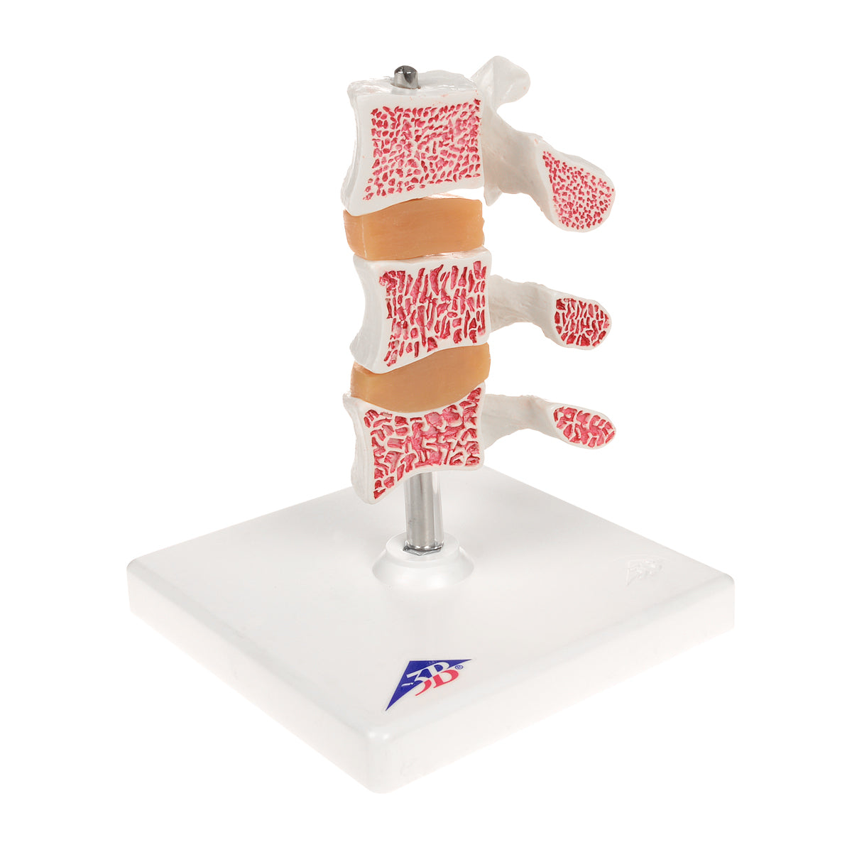 Deluxe Human Osteoporosis Model (3 Vertebrae with Discs), Removable on Stand - 3B Scientific A78, view 7