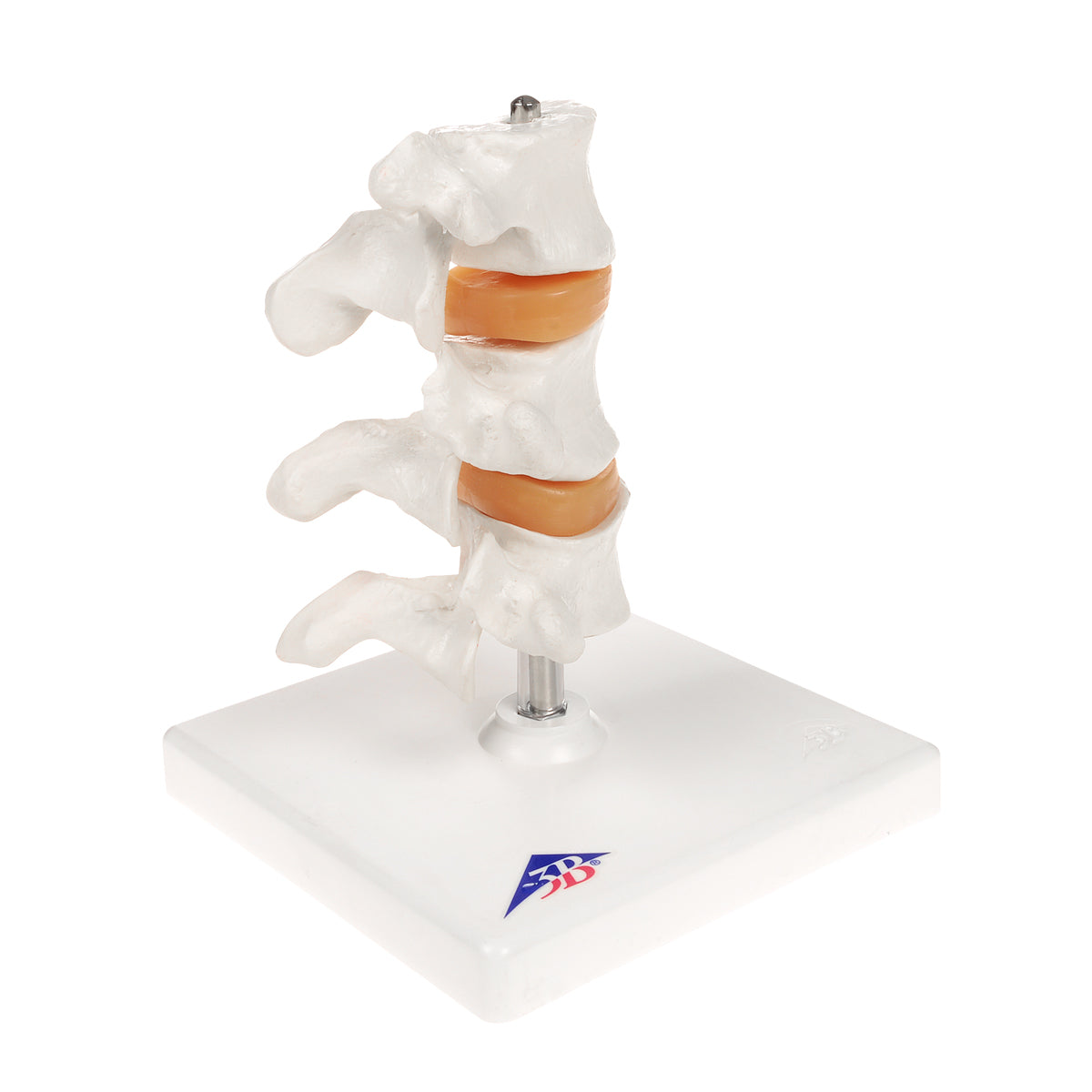 Deluxe Human Osteoporosis Model (3 Vertebrae with Discs), Removable on Stand - 3B Scientific A78, view 8