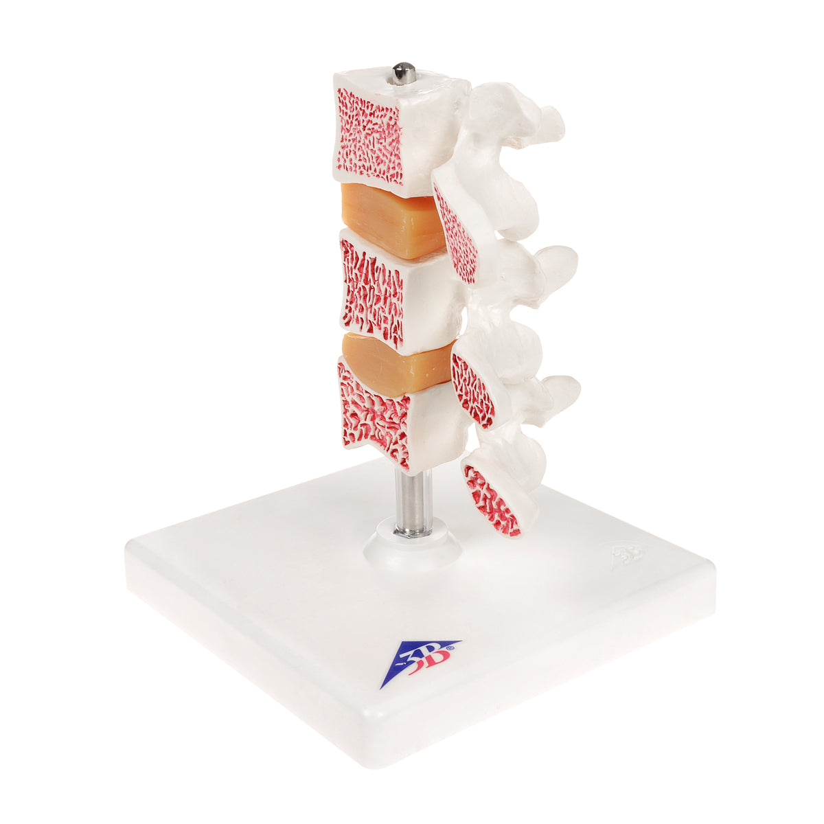Deluxe Human Osteoporosis Model (3 Vertebrae with Discs), Removable on Stand - 3B Scientific A78, view 9