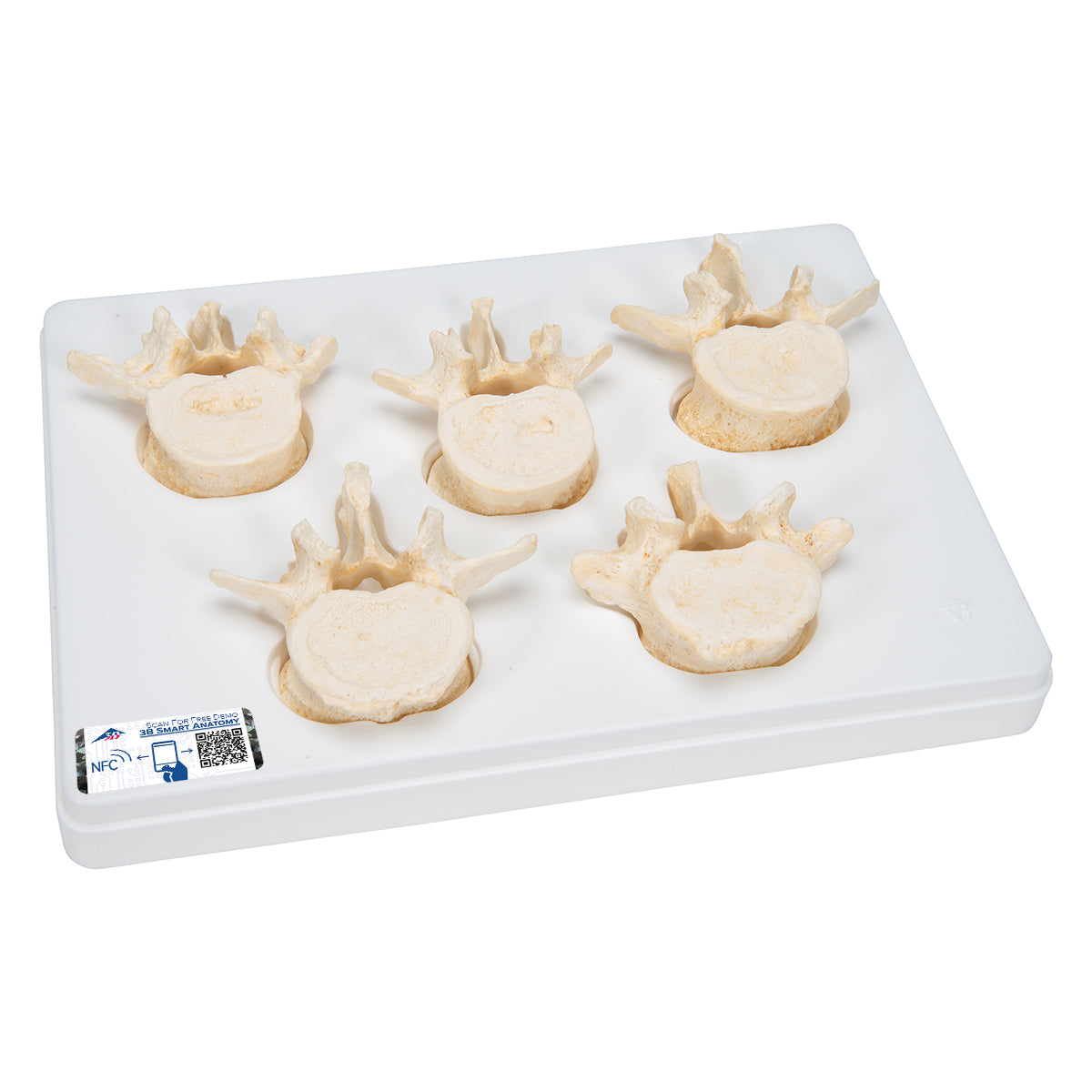 Set of 5 BONElike Lumbar Vertebrae - 3B Scientific A792, view 5