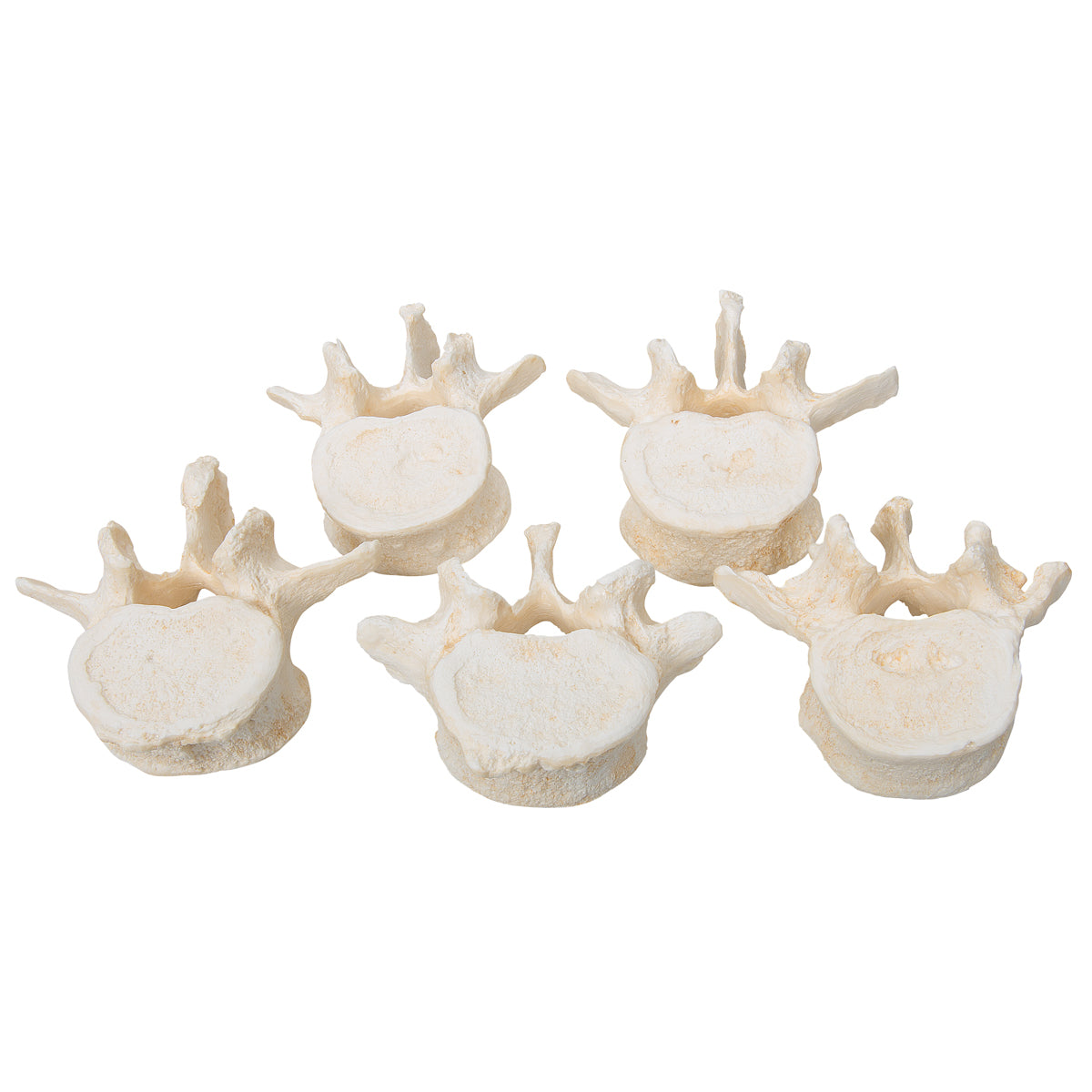 Set of 5 BONElike Lumbar Vertebrae - 3B Scientific A792, view 4