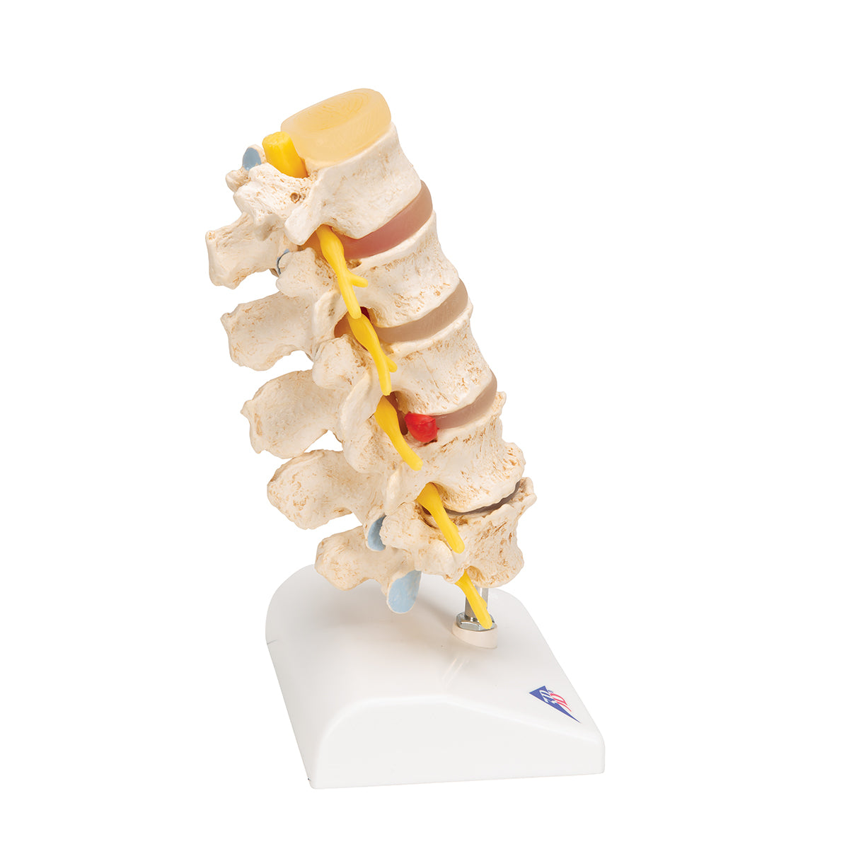 Stages of disc prolapse and vertebral degeneration - 3B Scientific A795, view 3