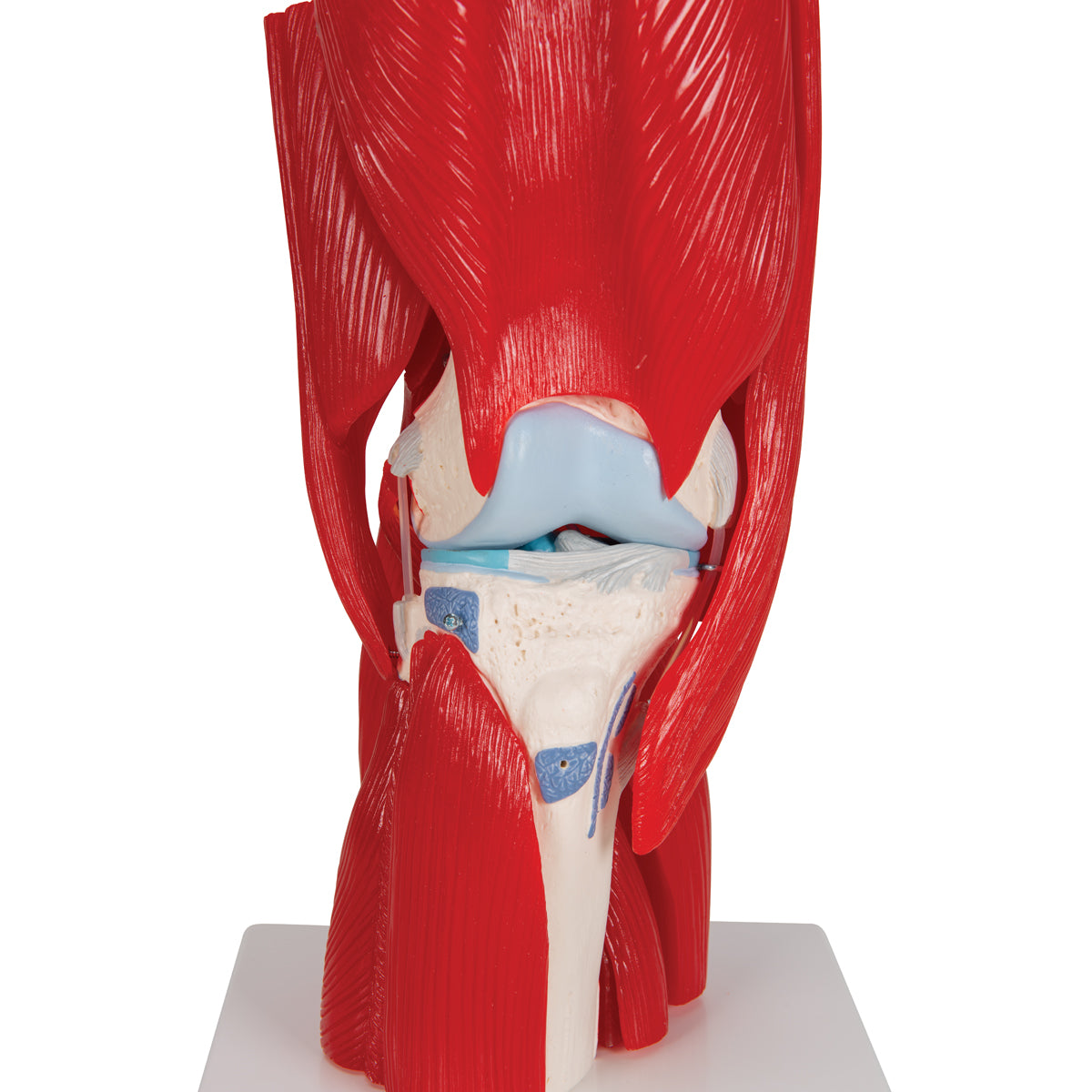 Human Knee Joint Model with Removable Muscles, 12 parts - 3B Scientific A882, view 7