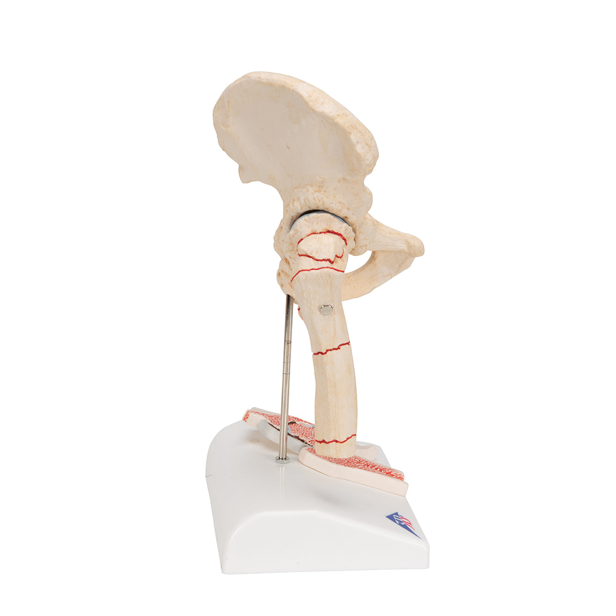 Human Femoral Fracture & Hip Osteoarthritis Model - 3B Scientific A88, view 3
