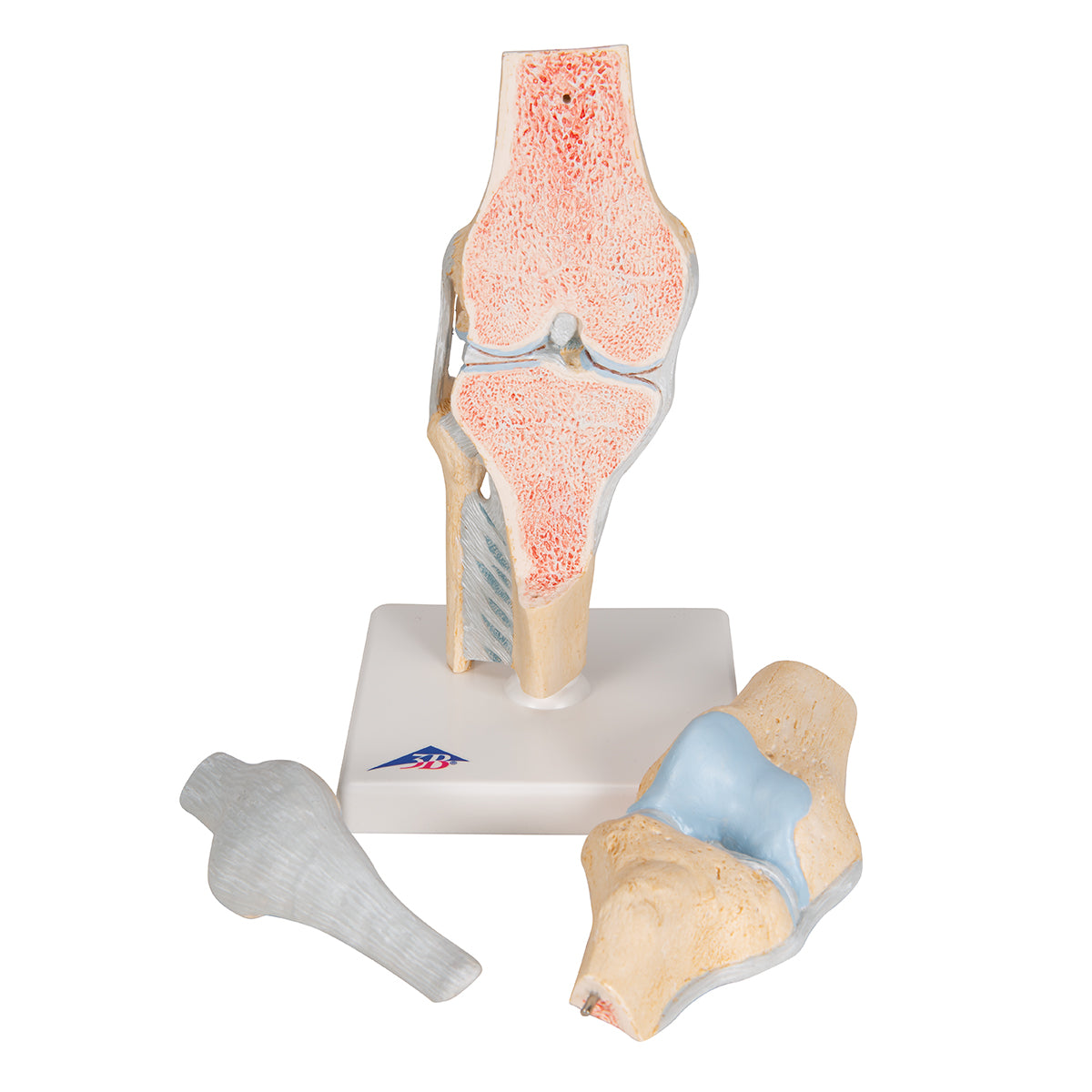 Sectional Human Knee Joint Model, 3 part - 3B Scientific A89, view 12