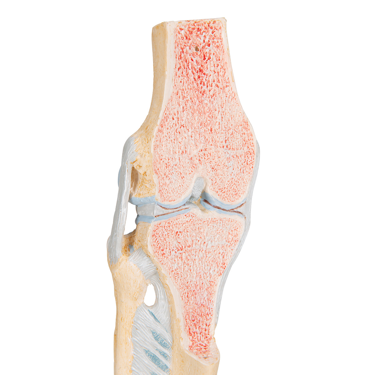 Sectional Human Knee Joint Model, 3 part - 3B Scientific A89, view 13