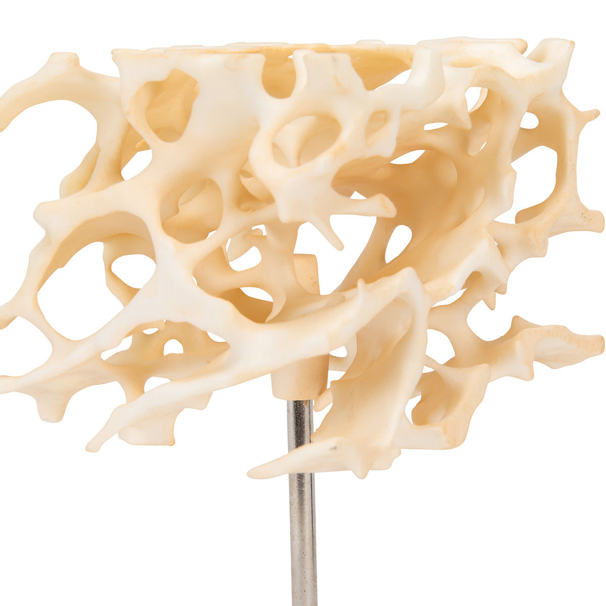 Human Cancellous Bone Model, Enlarged 100 times - 3B Scientific A99, view 7