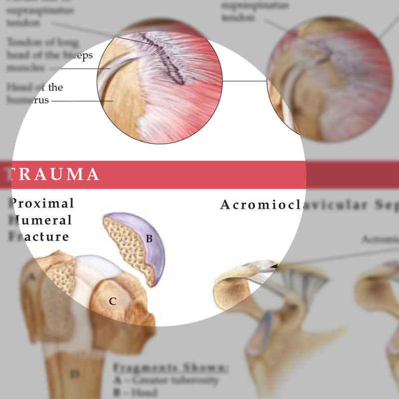 Anatomy and Injuries of the Shoulder - detail