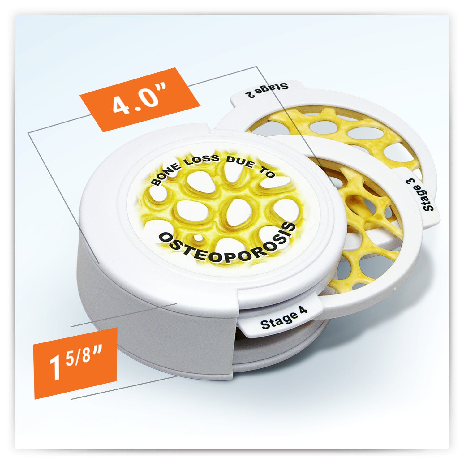 Osteoporosis Hinged Disk Set
