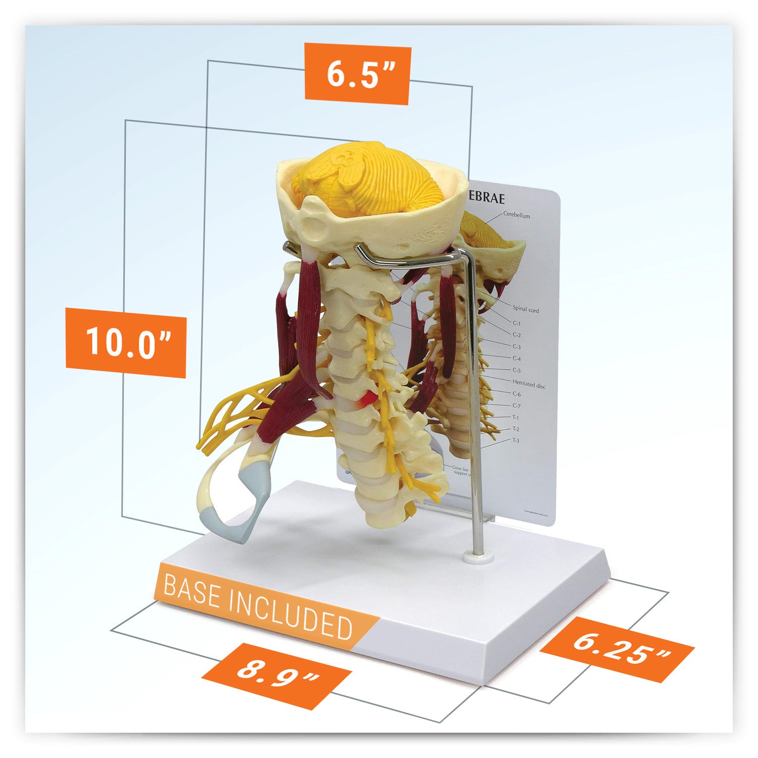 Muscled Cervical Vertebrae