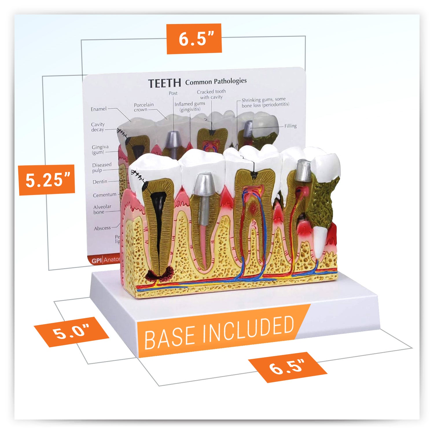 Teeth (Healthy/Pathologies)