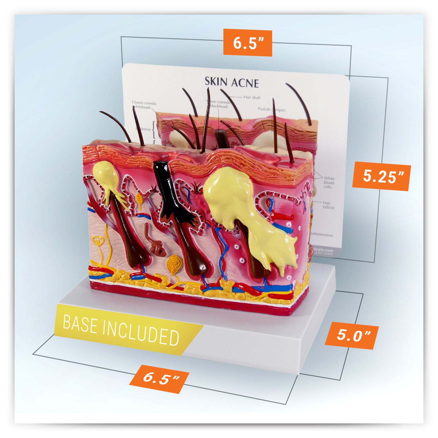 Skin Acne & Normal Skin (2-Sided)