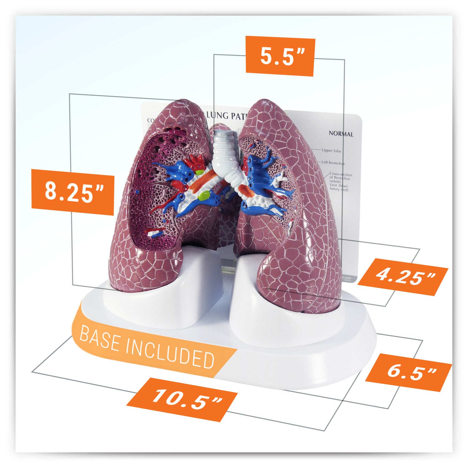 Lung Set (with Pathologies)