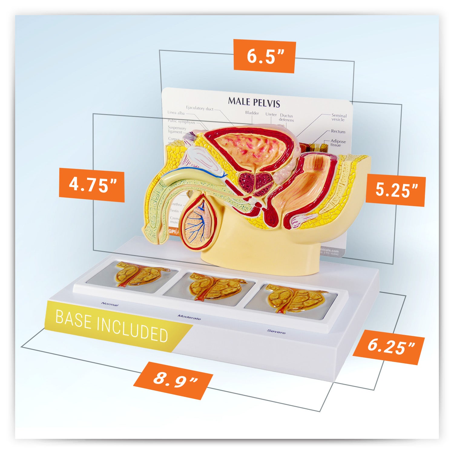 Male Pelvis with 3D Prostate Frame