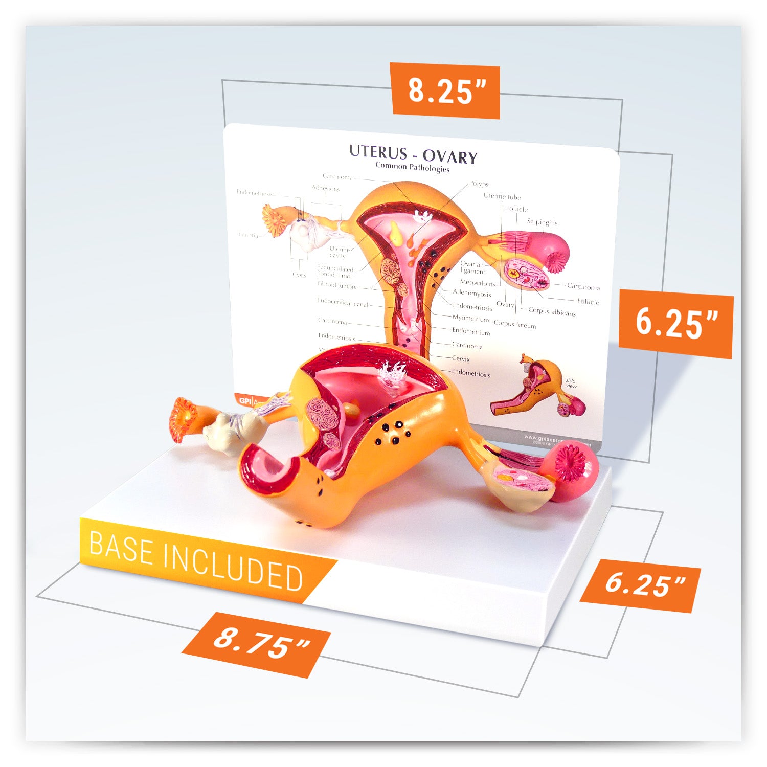 Uterus/Ovary