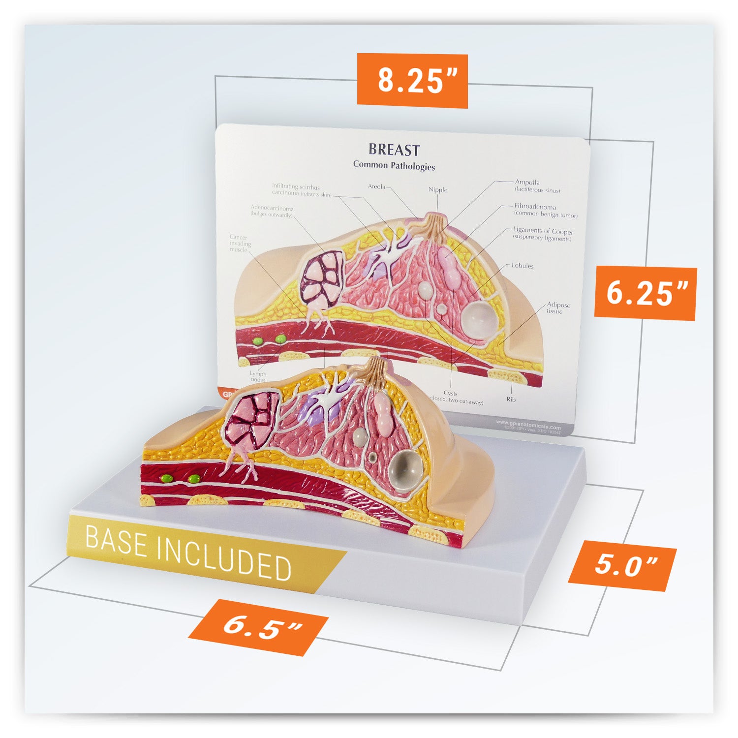 Breast Cross-Section