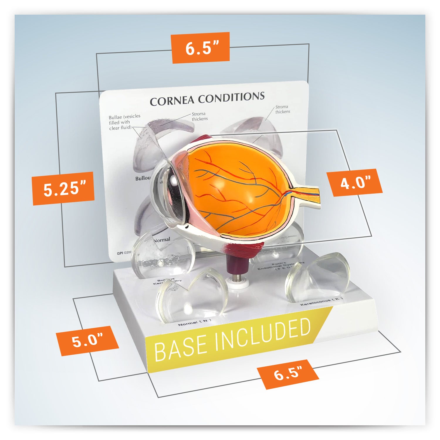 Cornea Eye (cut-away)